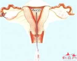深圳助孕流程 怀孕期间，老人常说的这3个禁忌，