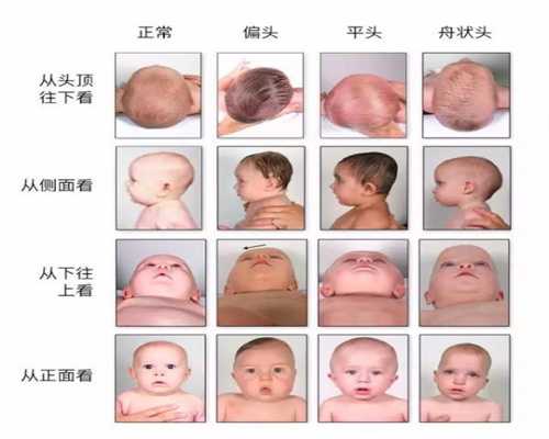 忻州专业代孕中心：怀孕了能不能吃柿饼